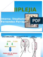 Hemiplejia: definición, causas, evaluación y fases