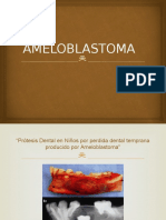 AMELOBLASTOMA