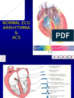 Normal Ecg Arrhythmia & ACS
