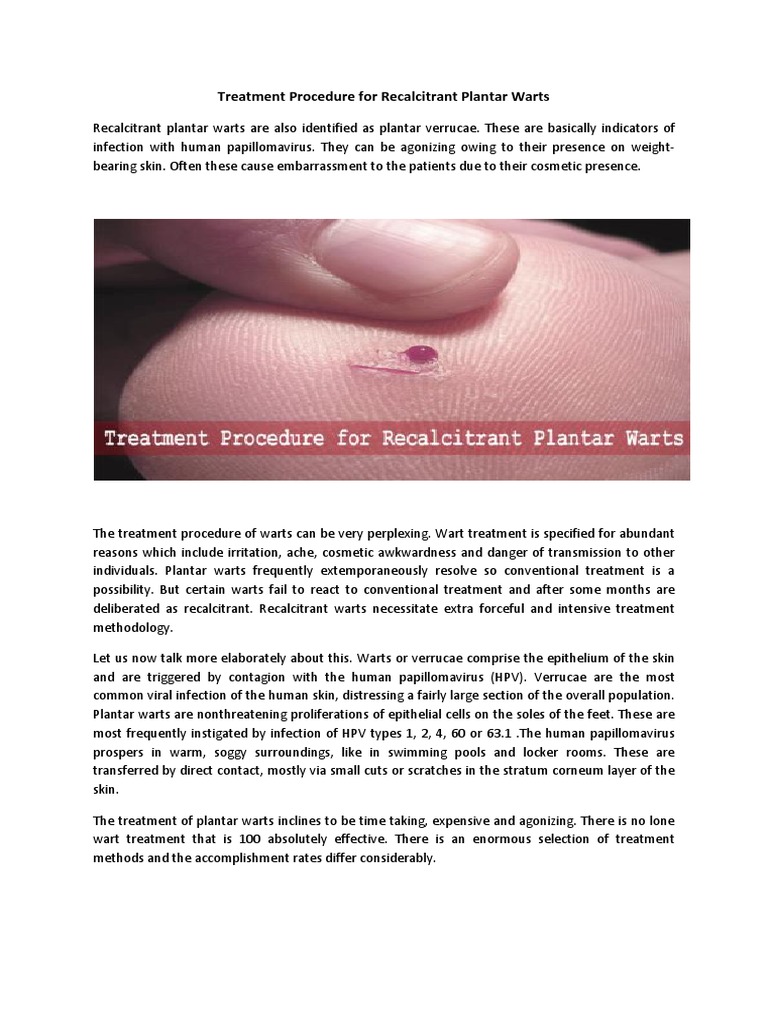 Treatment Procedure For Recalcitrant Plantar Warts Interferon