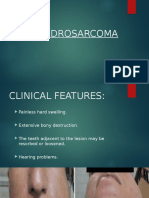 Chondrosarcoma Osski