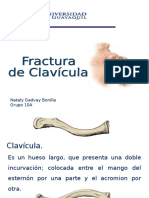FX de Clavicula