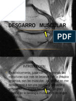Desgarro Muscular