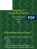 Benign Bone Tumor
