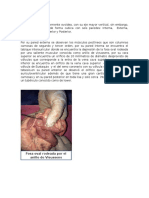 Aurículas: anatomía, estructuras y orificios