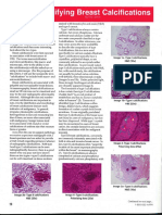 AAPA Breast Calcification Article Tisa Lawless