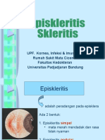 Episkleritis & Skleritis