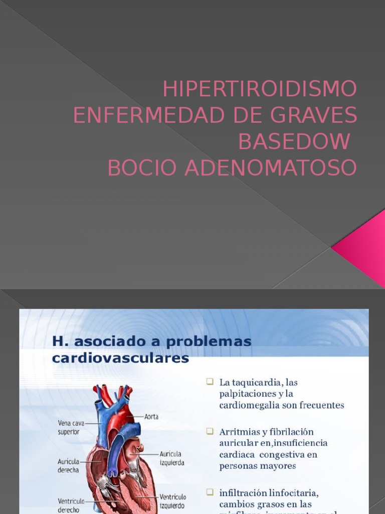 Enfermedad de Graves Basedow Hormona estimulante de la tiroides Hipotiroidismo