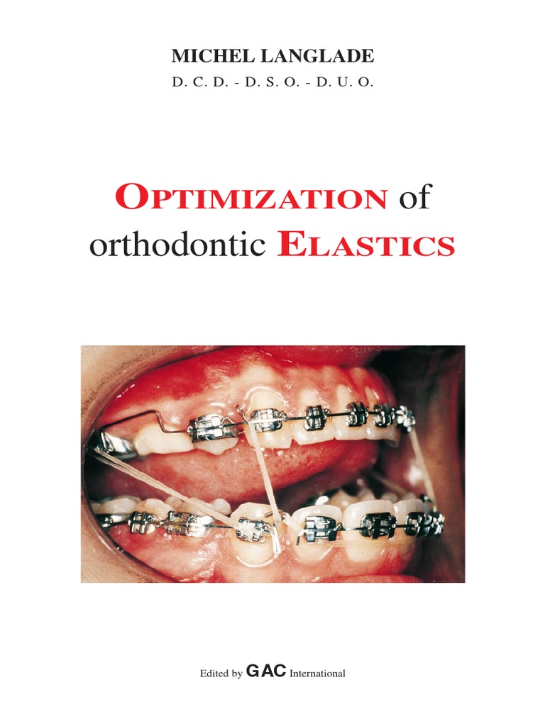 Optimization of Orthodontic Elastics Langlade Dentistry Branches