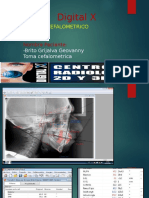 Estudios Cefalometricos (Reparado)