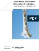 LCP Extra-Articular Distal Humerus Plate