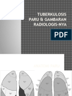 Radiologi Tb