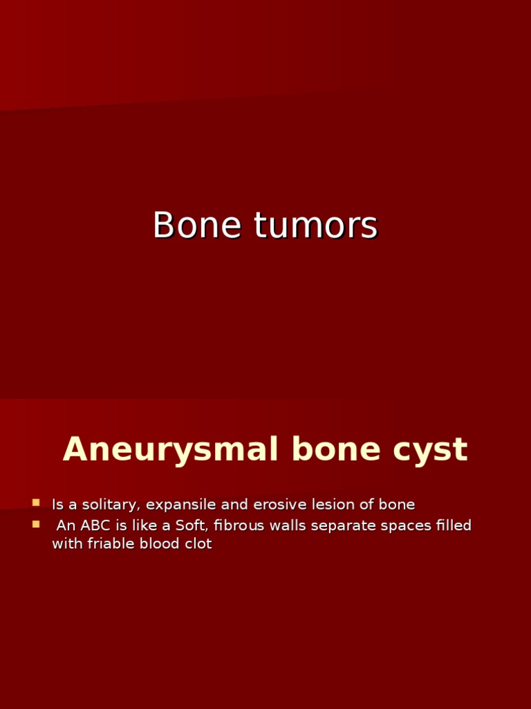 ABC Bone Cyst PDF Metastasis Bone