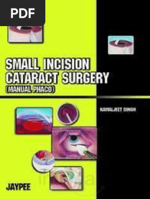 Small Incision Cataract Surgery Pdf Ophthalmology Surgery