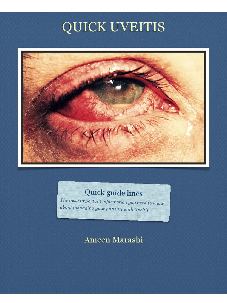 Uveitis Management Guidelines | PDF | Science & Mathematics