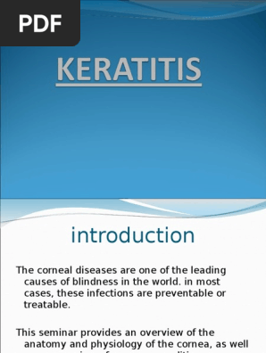 Keratitis Ppt Ppt Herpes Simplex Cornea