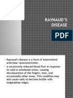 Raynaud - S Dse