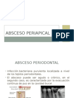 Absceso Periapical