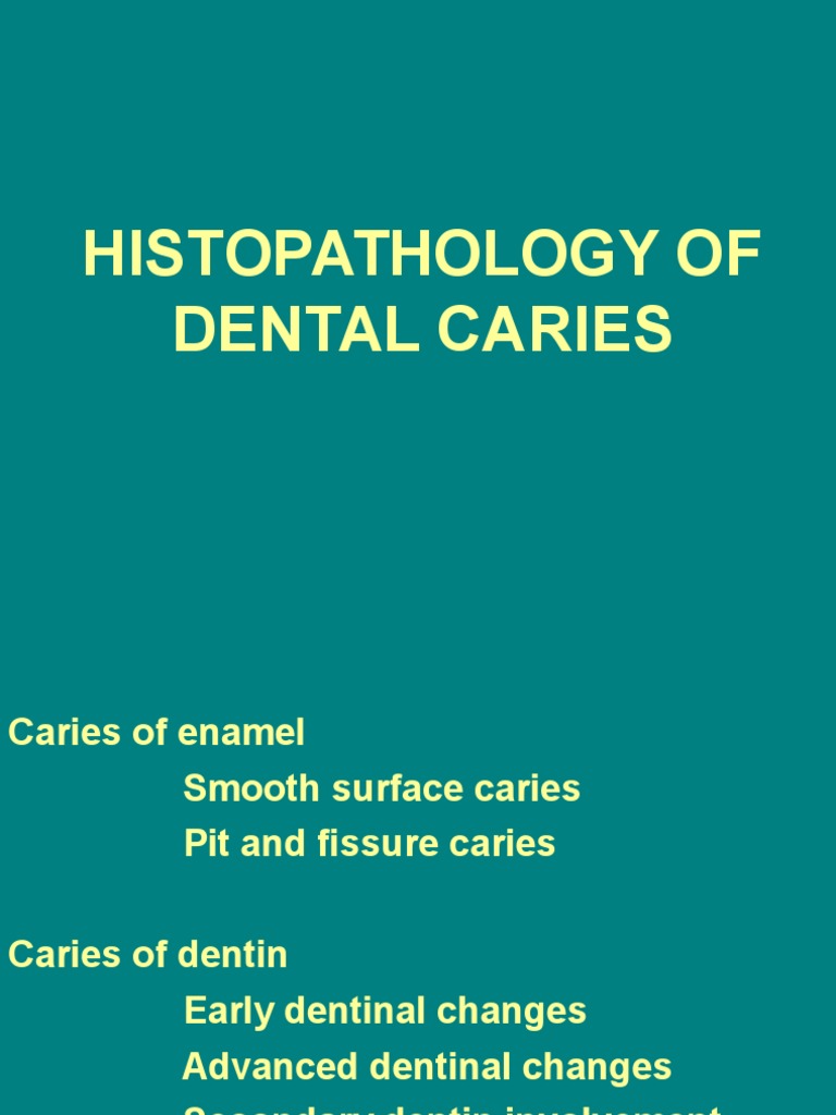 Histopathology of Dental Caries Zones | PDF | Dentin | Tooth Enamel
