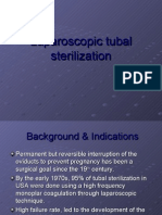Laparoscopic tubal sterilization
