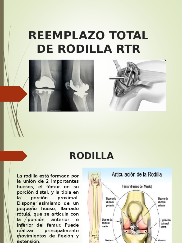 Reemplazo Total de Rodilla Rtr Rodilla Ciencia de la danza