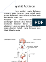 Penyakit Addison dan Fungsi Kelenjar Adrenal