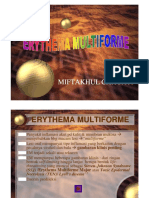 Erythema Multiforme 