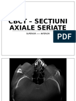 CBCT Sectiuni Axiale
