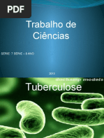 Trabalho de Ciências - Tuberculose