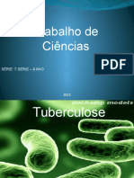 Trabalho de Ciências - Tuberculose