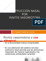 Obstruccionnasalporrinitisvasomotora