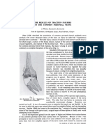 The Results of Traction Injuries of CPN