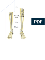 Peroneal Palsy