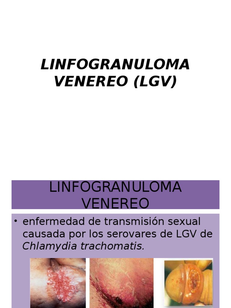 LINFOGRANULOMA VENEREO (LGV)