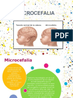 Microencefalia