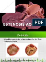 Estenosis Aortica