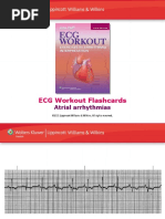 ECG Workout Flashcards: Atrial Arrhythmias