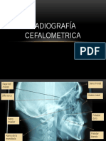 Radio Cefalometria