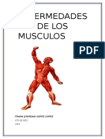 Enfermedades de Los Musculos