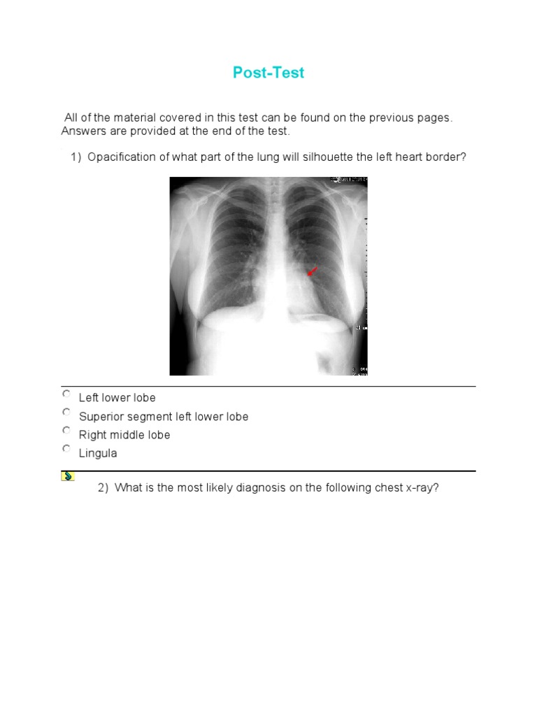 Chest X-Ray Interpretation Test | PDF | Aorta | Lung