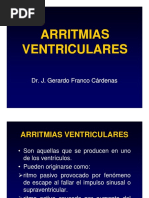 arritmiasventri-100124133935-phpapp01
