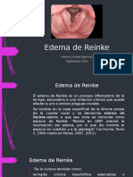 Edema de Reinke