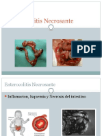 Enterocolitis Necrosante