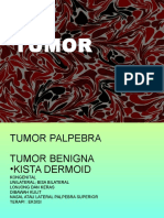 Tumor Palpebra