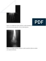 Imagenes TB Osteoarticular