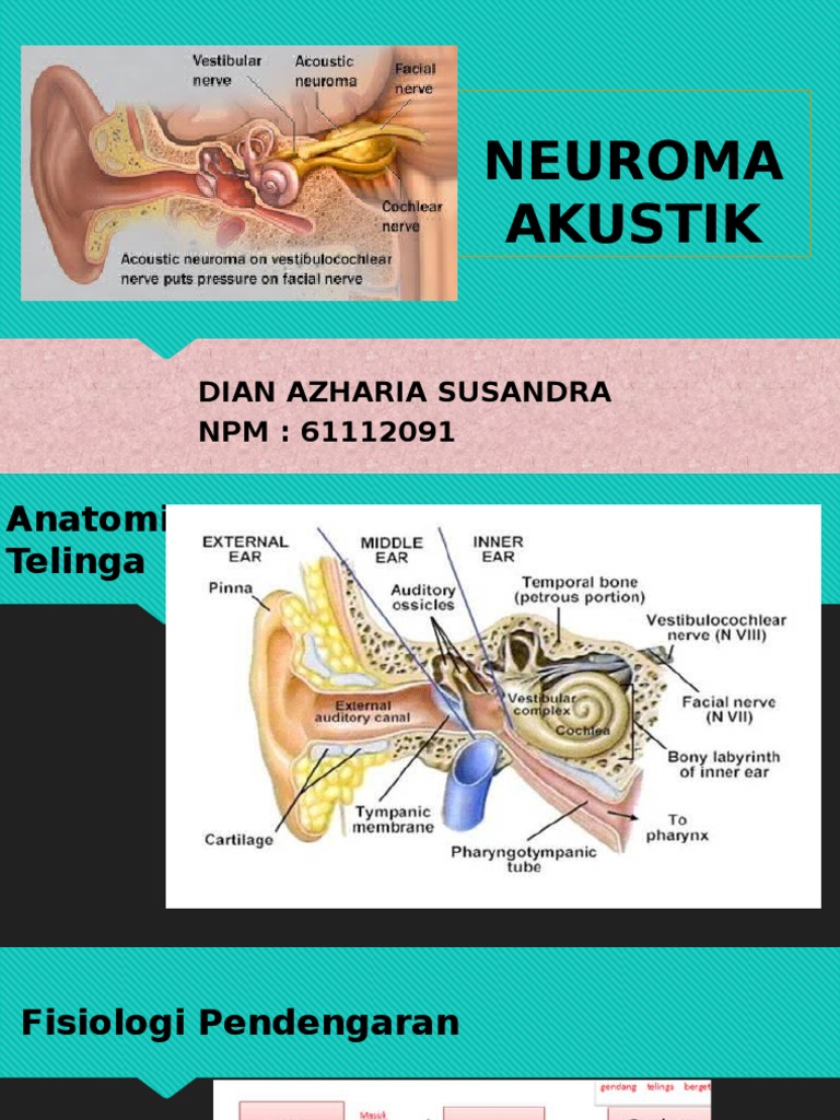 NEUROMA AKUSTIK PPT.pptx