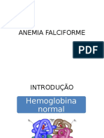 Anemia Falciforme