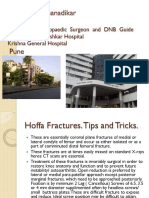 Hoffa Fractures Tips and Tricks.