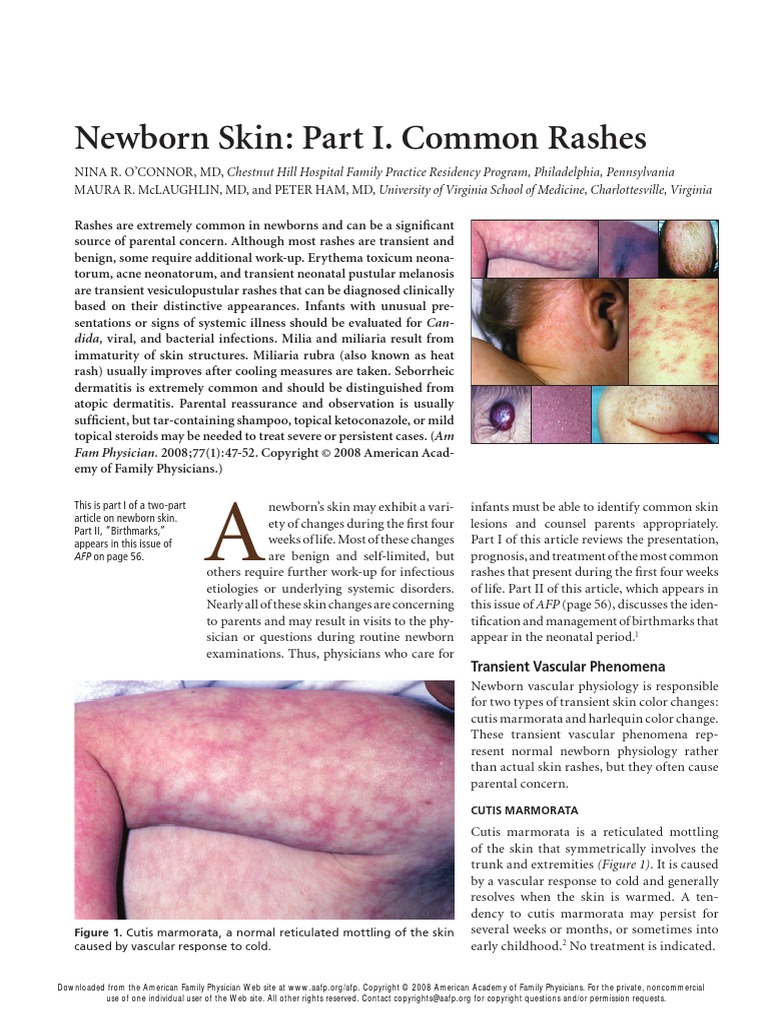 Neonatal Rashes PDF PDF Dermatitis Cutaneous Conditions