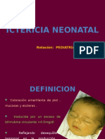 Ictericia